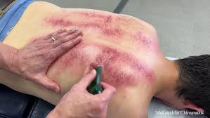 Fullbody Massage + Kerok